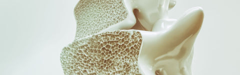 Bombshell Causes of Osteoporosis